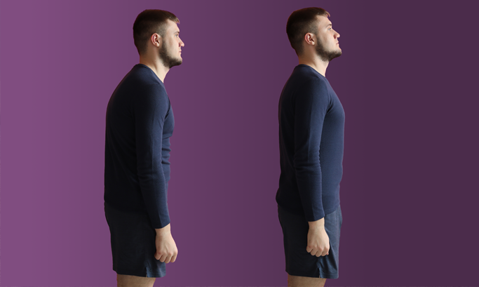 Progress photos showing a mans posture before and after pics